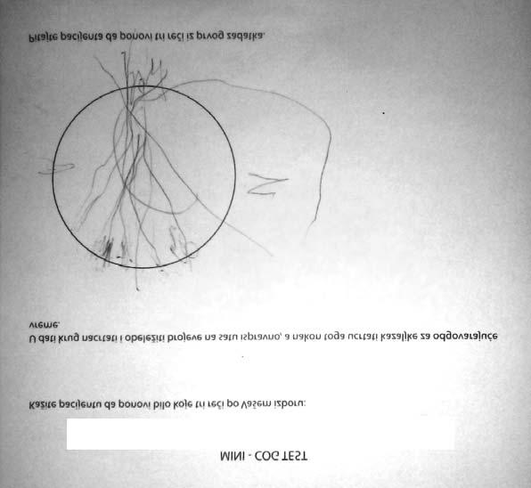 gubitkom samostalnosti u obavljanju aktivnosti svakodnevnog života. Mini- Cog test (rezultat 0/4), prikazan je na slici 1.