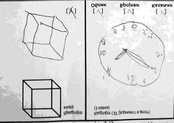 I dalje je bio zavistan od nege drugog lica, ali uz veći stepen samostalnosti u izvođenju svakodnevnih aktivnosti (npr.