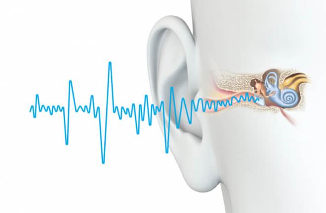 Uzroci tinitusa ili zujanja u ušima su: izloženost buci - buka uzrokuje trajnu štetu na zvučno-osjetljivim stanicama pužnice, spiralno-oblikovanom organu u unutarnjem uhu, začepljenost uha zbog ušnog