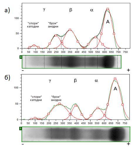 Слика 3.3. Електрофореза протеина серума здраве (а) и болесне (б) телади у гелу агарозе. А: албумин, α, β и γ глобулини.