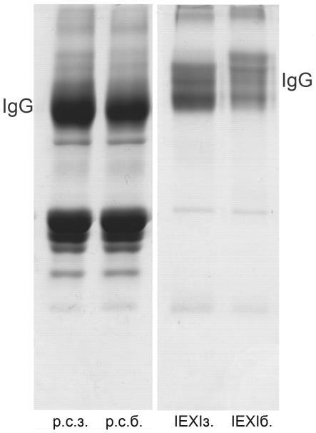 Поређење електрофоретских карактеристика различитих изолата IgG серума здраве (з) и телади са бронхопнеумонијом (б).