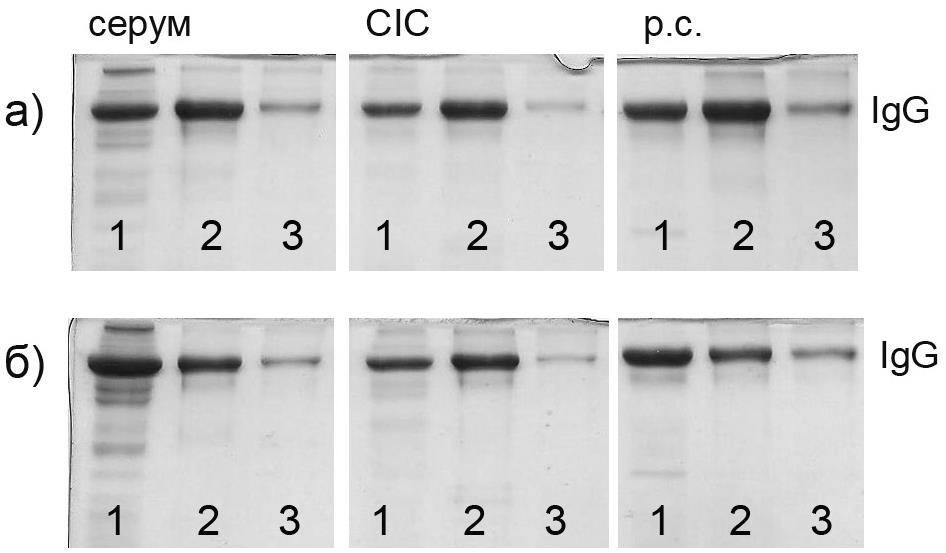 Слика 3.14. IgG из серума, CIC и риванол-солубилних протеина серума здраве телади (а) и телади са бронхопнеумонијом (б) афинитетно изоловани на протеин G и протеин A Dynabeads матриксу.
