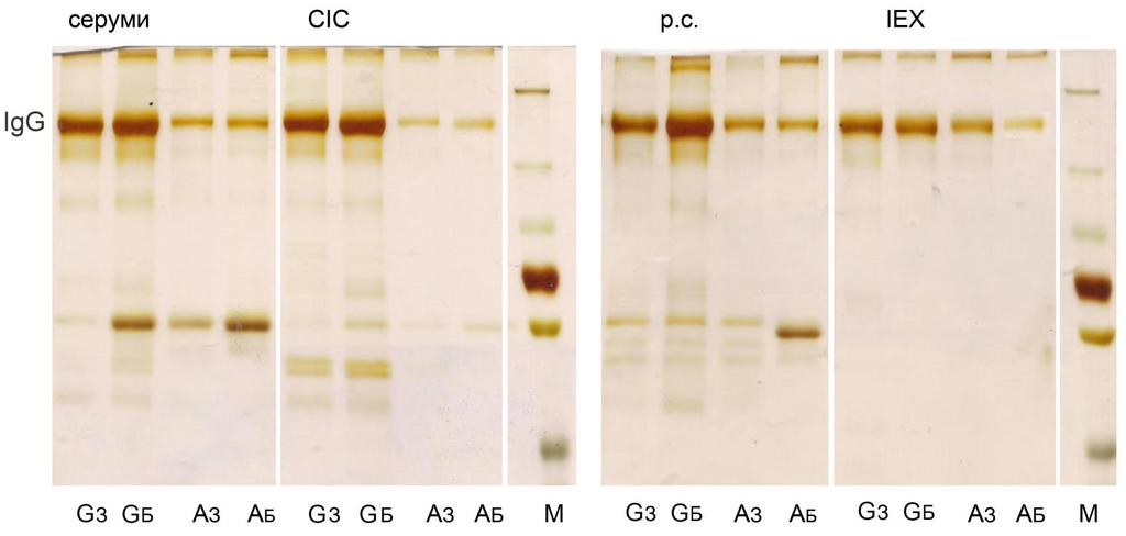 Слика 3.15. SDS-PAGE у нередукујућим условима: IgG афинитетно изоловани на протеин G и протеин A Dynabeads матриксу из збирних узорака серума, CIC, риванол солубилних протеина серума (р.с.) и протеина серума изолованих анјонском измењивачком хроматографијом (IEX) здраве телади (З) и телади са бронхопнеумонијом (Б).
