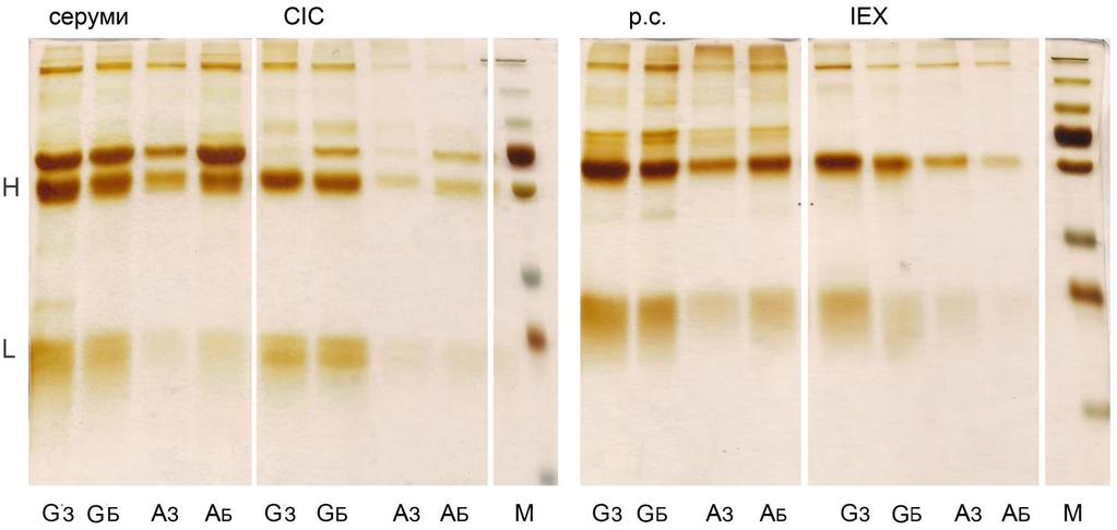 Слика 3.16. SDS-PAGE у редукујућим условима: IgG афинитетно изоловани на протеин G и протеин A Dynabeads матриксу из збирних узорака серума, CIC, риванол-солубилних протеина серума (р.с.) и протеина серума изолованих анјонском измењивачком хроматографијом (IEX) здраве телади (З) и телади са бронхопнеумонијом (Б).