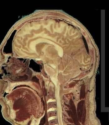 Mozak: osnovna graña Veliki mozak (cerebrum) Meñumozak (diencephalon)