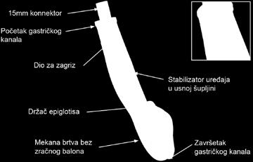 U tom slučaju treba posegnuti za alternativnim metodama uspostavljanja prohodnosti dišnih putova. Jedna od tih metoda je i postavljanje laringealne maske. Slika 29.