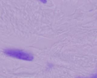 Slika 7 Primjer ulazne mikroskopske slike (gore) i nekoliko detektiranih stanica (dolje) Zadani