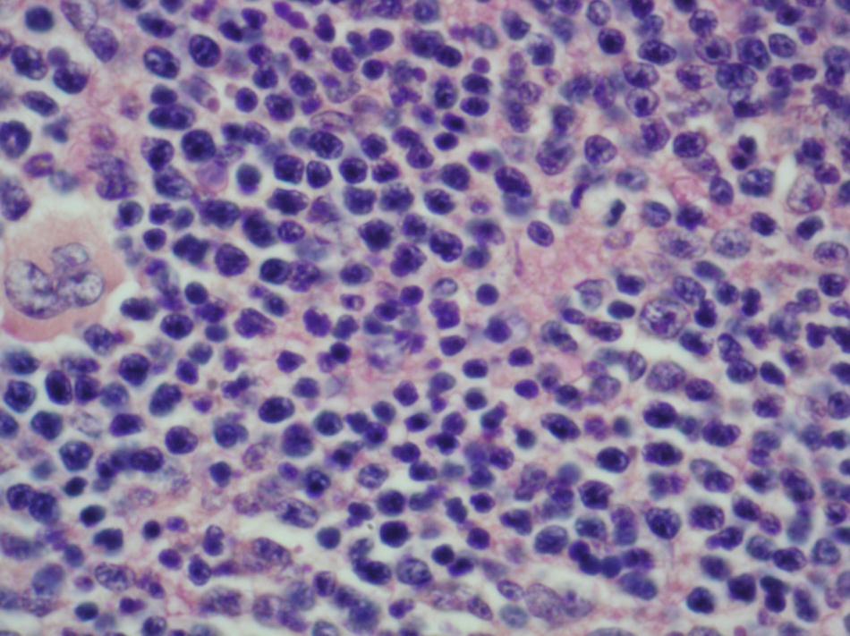 Slika 11. Hematopoezno tkivo slezine.