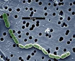 4 15. MLF fermentaciju izazivaju malolaktiĉne bakterije: Oenococcus oeni u procesu prizvodnje vina, obiĉno nastupa nakon fermentacije 15.Koji su mikroorganizmi prikazani na slikama 16.