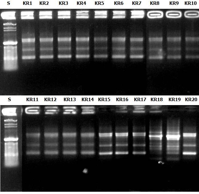 bakterija se mogu detektirati zahvaljujući varijacijama u mjestima vezanja početnica na DNA te razlikama u duljinama amplicifiranih fragmenata.