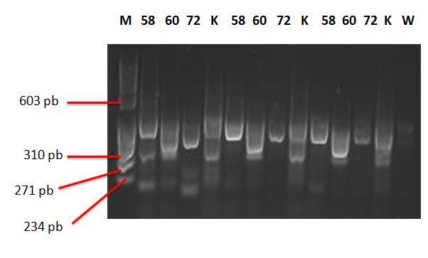Slika 7. Optimizacija koncentracije MgCl2 u reakcijama RT-PCR-a (brojevi iznad slike odgovaraju uzorcima u Tablici 6.).