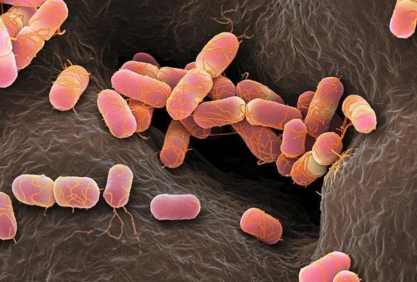 Escherichia coli Slika 9. Escherichia coli Escherichia coli je Gram-negativna bakterija pokretni fakultativno anaerobni bacil, sa peritrihalnim flagelama. To su pravi štapići, preĉnika 1-1.