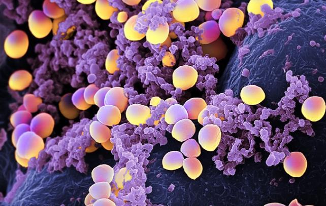 Staphylococcus aureus Slika 10. Staphylococcus aureus Predstavnici ovog roda su loptastog oblika, najĉešće rasporeċeni u vidu grozdastih formacija. Gram pozitivna je.