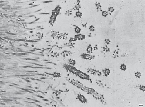 fimbriae važne kod kolonizacije, jer fimbrijski deficijentni mutanti pokazuju smanjenu sposobnost vezanja i invazije epitelnih stanica i fibroblasta.