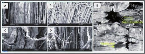 Slika 2 Prilikom prekomerne aktivnosti, starenja i povrede, nastaju tipične mikroskopske promene; među njima, progresivni gubitak poravnanja kolagenih vlakana (A-D) i takozvanih izjedenih tkiva (E).