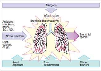 BRONHALNA ASTMA Boluje oko 5-10% populacije Akutna i kronična Rekurentne, reverzibilne epizode kašlja, nedostatka zraka,