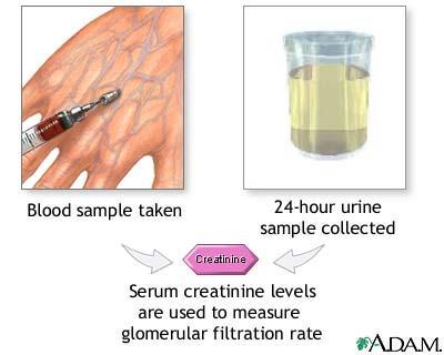 Serumski kreatinin ( 62-110 mmol/l) Indikacije: evaluaciju bubrežne funkcije glomerularne filtracije (GF) Funkcija bubrega oštećena raste kreatinin u krvi smanjuje se eskrecija kreatinin u urinu