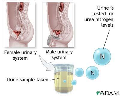Uroanaliza Indikacije: fizikalni, hemijski i mikroskopski pregled urina u cilju skrininga UTI, renalnih bolesti i drugih poremećaja Priprema:sakupiti srednji čisti mlaz prvog juratnjeg urina nakon