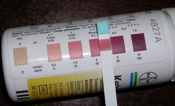 Slika 9: Rezultati mjerenja ketona u urinu Ketoni se također mogu kontrolirati kod kuće sa test trakicama iz kapi krvi.