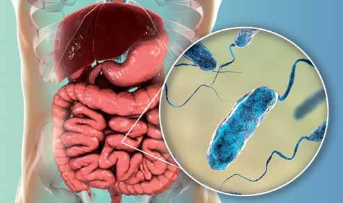 fatalne dehidracije Piše Mario Sušanj, dr. med. spec. epidemiologije Kolera je zarazna bolest probavnog trakta koju uzrokuje bakterija Vibrio cholerae.