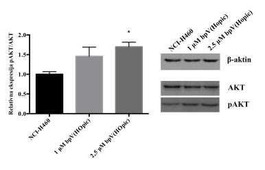 Slika 7. Western blot analiza AKT proteina i njegove fosforilisane forme kod NCI-H460 ćelija tretiranih inhibitorom PTEN tumor supresora (bpv(hopic)).