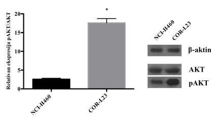 Slika 10. Western blot analiza AKT proteina i njegove fosforilisane forme kod NCI-H460 i COR- L23 ćelijske linije.