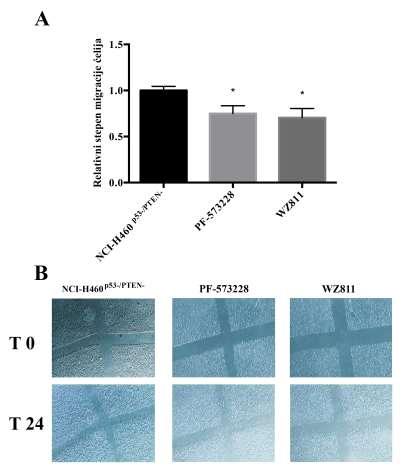 4.4. ANTI-INVAZIVNI EFEKTI PF-573228 I WZ811 INHIBITORA NA NSCLC ĆELIJSKIM LINIJAMA SA NEAKTIVNIM P53 I PTEN TUMOR SUPRESORIMA U daljim eksperimentima ispitivano je da li inhibicija CXCR4 i FAK-a ima