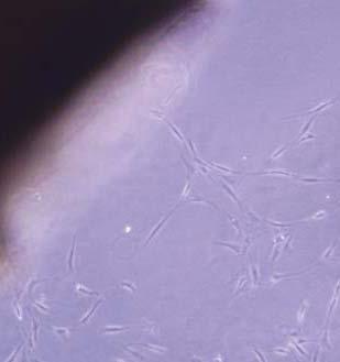 Tri dana nakon inokulacije u primarnoj kulturi su fazno-kontrastnim mikroskopom raspoznavane VSMC koje su se množile i migrirale od dela tkiva, a nakon 5 dana od inokulacije, kultura ćelija je već