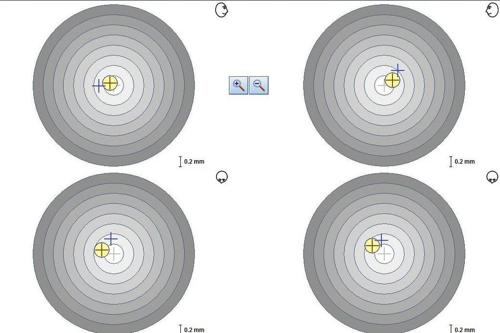 Slika 6. Modul Electronic Position Analysis ultrazvučnog mjernog uređaja. Preuzeto s dopuštenjem autora: doc. dr. sc. Samir Čimić. Tablica 2.