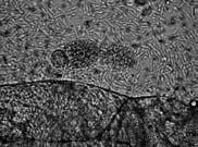 Entomopoxvirus u Ips typographus Figure 1 Entomopox virus in Ips typographus Slika 2.