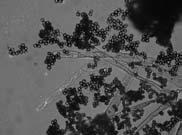 Figure 2 Giemsa stained spores of the microsponidia Canningia spinidentis in Pityokteines spinidens (arrow: u or v structure of