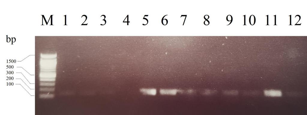 Slika 13: Produkti PCR reakcije. Elektroforeza na agaroznom gelu plazmida izoliranih iz 10 različitih bakterijskih kolonija.