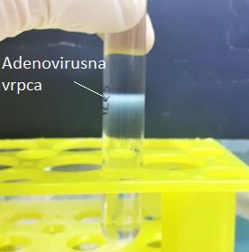 Slika 19: Adenovirusna vrpca nakon drugog centrifugiranja U svrhu određivanja koncentracije adenovirusnih čestica u suspenziji pročišćenih adenovirusa mjerenjem apsorbancije pri 260 nm u razrjeđenju