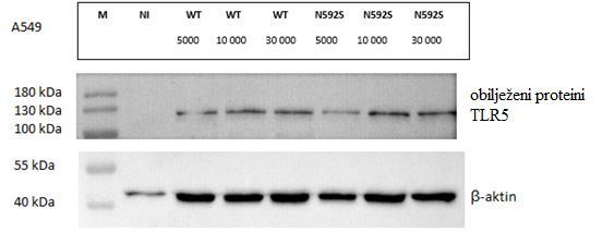 4.9. Unos gena TLR5 wt i TLR5 N592S u humane stanice pluća U svrhu infekcije stanične linije A549, WI38, H1299 inficirane su virusnim česticama tako što je u bunariće za svaku staničnu liniju dodano