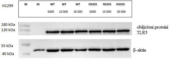 Slika 21: Analiza ekspresije proteina TLR5 u staničnoj liniji H1299, metodom Western blot pomoću sekundarnog anti-mišjeg imunoglobulina G antitijela s konjugiranom peroksidazom.
