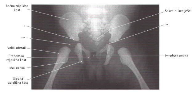 2. Sjedne kosti (lat. ischial tuberosities) Slika 7. Kosti zdjelice, rendgenska snimka [1] Zdjelični obruč lat. cingulum pelvicum, čine četiri kosti: dvije zdjelične kosti lat.