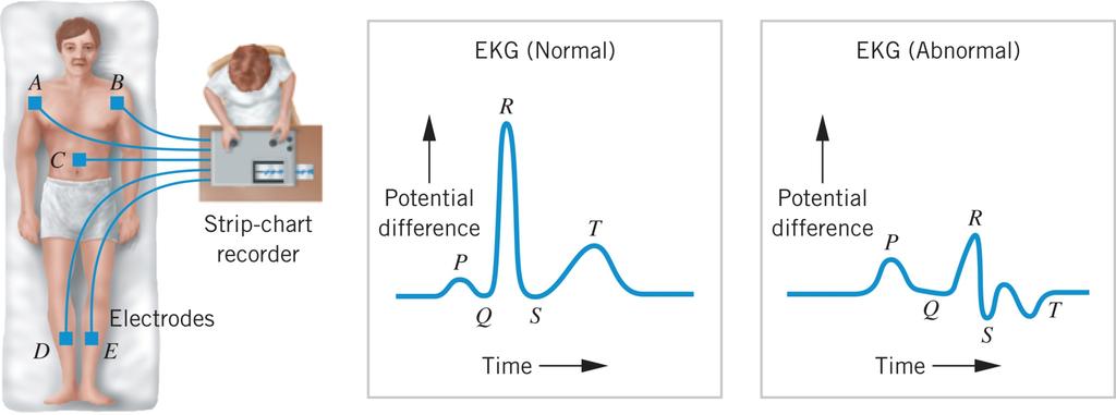 19.6 Biomediconske primjene razlike električnog potencijala EKG = ElektroKardioGrafija (dijagnostička metoda kojom se