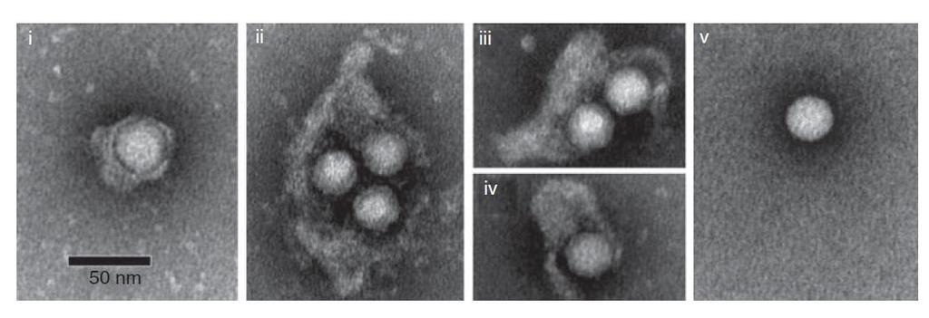 Poluobavijene virusne čestice promjera su od 50 do 110 nm (Slika 4). Zrela virusna čestica i ehav imaju različitu strukturu kapside.
