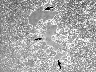 Slika 13. Nepromijenjen osteoblastogenetski potencijal stanica koštane srži miševa s transgenom za IL-7 (IL-7 TG).