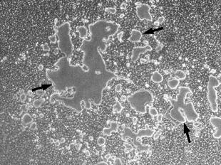 Kossa bojenje pokazalo njihov mineralizirajući potencijal. Wt osteoblastne kulture stanica koštane srži miševa divljeg tipa. 8 tj miševi stari 8 tjedana, 12 mj miševi stari 12 mjeseci. a) b) Slika 14.