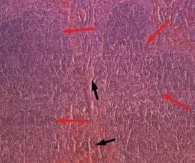 a) b) Slika 18. Tkivo slezene (HE bojenje): a) miša divljeg tipa i b) IL-7 TG miša.
