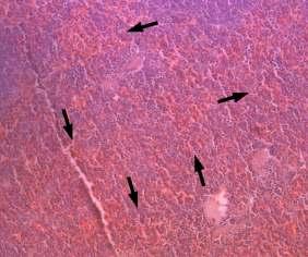pulpu (crne strelice), dok je u IL-7 TG miša tkivo slezene prožeto nezrelim limfocitima (sitne