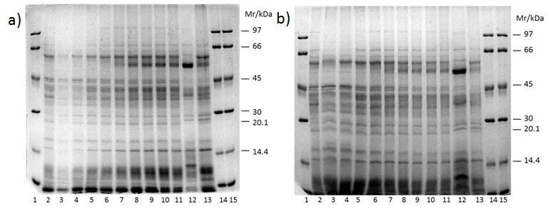 rasporedom proteinskih vrpci albumina (Slika 17a, linije 2 i 3; Slika 18a, linija 2), globulina (Slika 17a, linija 13; Slika 18a, linija 12) i albuminsko/globulinske frakcije (Slika 17a, linija 14;