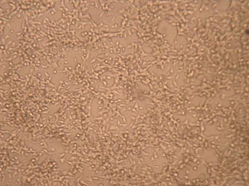 Нетретиране 4Т1 ћелије DE-EDCP (31.25µМ) DE-EDCP (62.5µМ) DE-EDCP (125µМ) Слика 7. Туморске 4T1 ћелије изложене DE-EDCP подлежу морфолошким променама.
