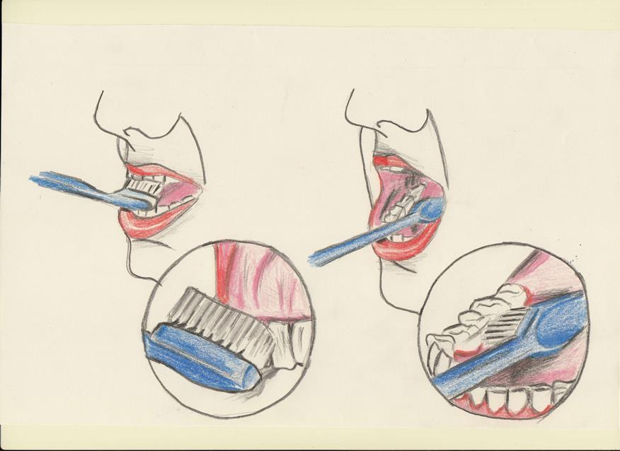 Slika 1. Pravilna upotreba četkice za zube Preporučuju se one s manjom glavom i mekanim ili srednje tvrdim vlaknima. Svaka 3 mjeseca potrebno je zamijeniti četkicu.