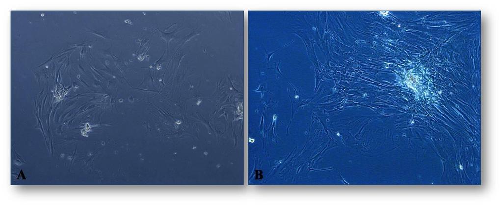 TakoĊe je zapaženo da je nakon trećeg pasaža proliferativna moć ovih ćelija bila maksimalna. Slika 9: A) ADSCs III pasaž, 1.dan, 100x, fazni kontrast; B) ADSCs III pasaž, 7.