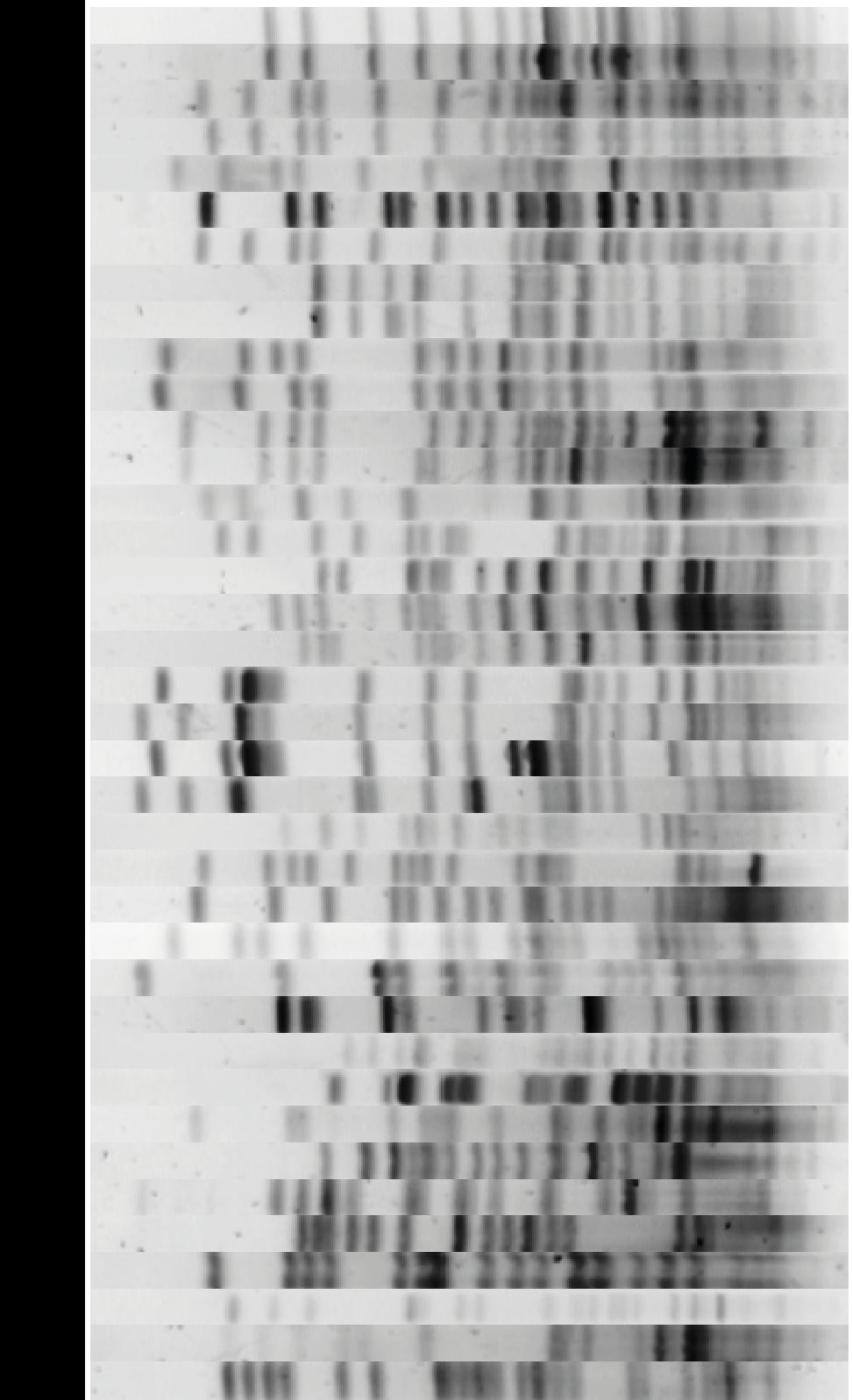 Slika 18. Prikaz svih makrorestrikcijskih profila izolata E.
