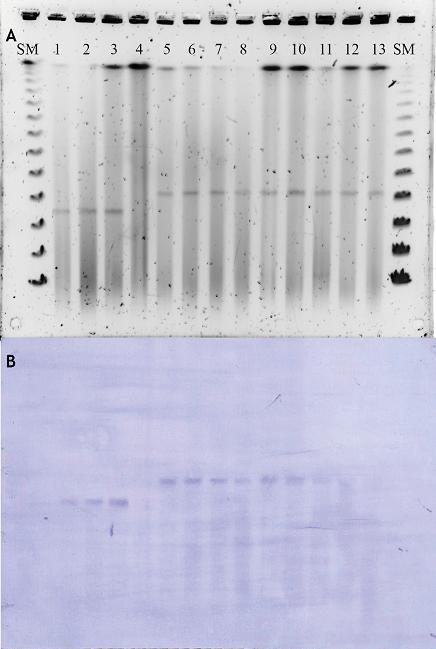 Slika 36. (A) plazmidni profili u VIM-1-producirajućih izolata E. cloacae dobiveni metodom S1-PFGE. SM standard molekulskih masa CHEF DNA Size Standard, 1 3 E. cloacae ST92, 4 negativna kontrola E.