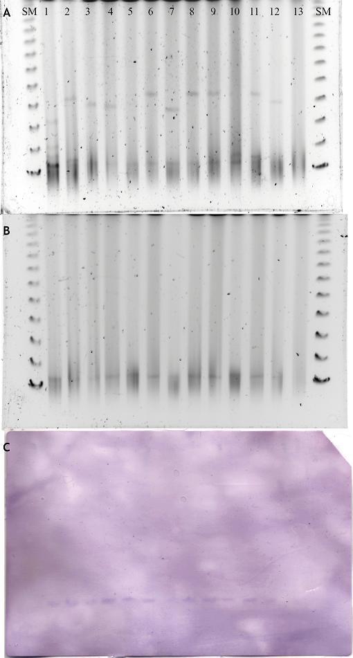 Slika 37. (A) plazmidni profili u OXA-48-producirajućih izolata K. pneumoniae dobiveni metodom S1-PFGE. (B) plazmidni profili u odgovarajućim OXA-48 transkonjugatima E. coli A15R.