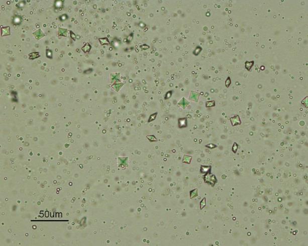 2.2.1. Oksalatni kamenci Najučestalija vrsta kamenaca su kamenci kalcijeva oksalata. [11] Oksalatni kamenci su izrazito rigidni, površina im je glatka, a boja je tamno siva ili tamnosmeđa.